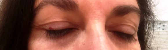 Lashes Before